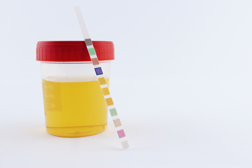 urine test tube and urine strip