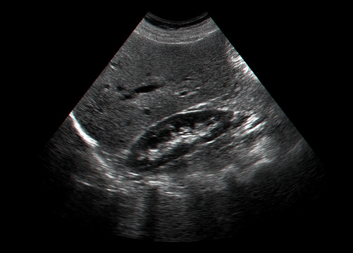 Medical ultrasound of human internal organs