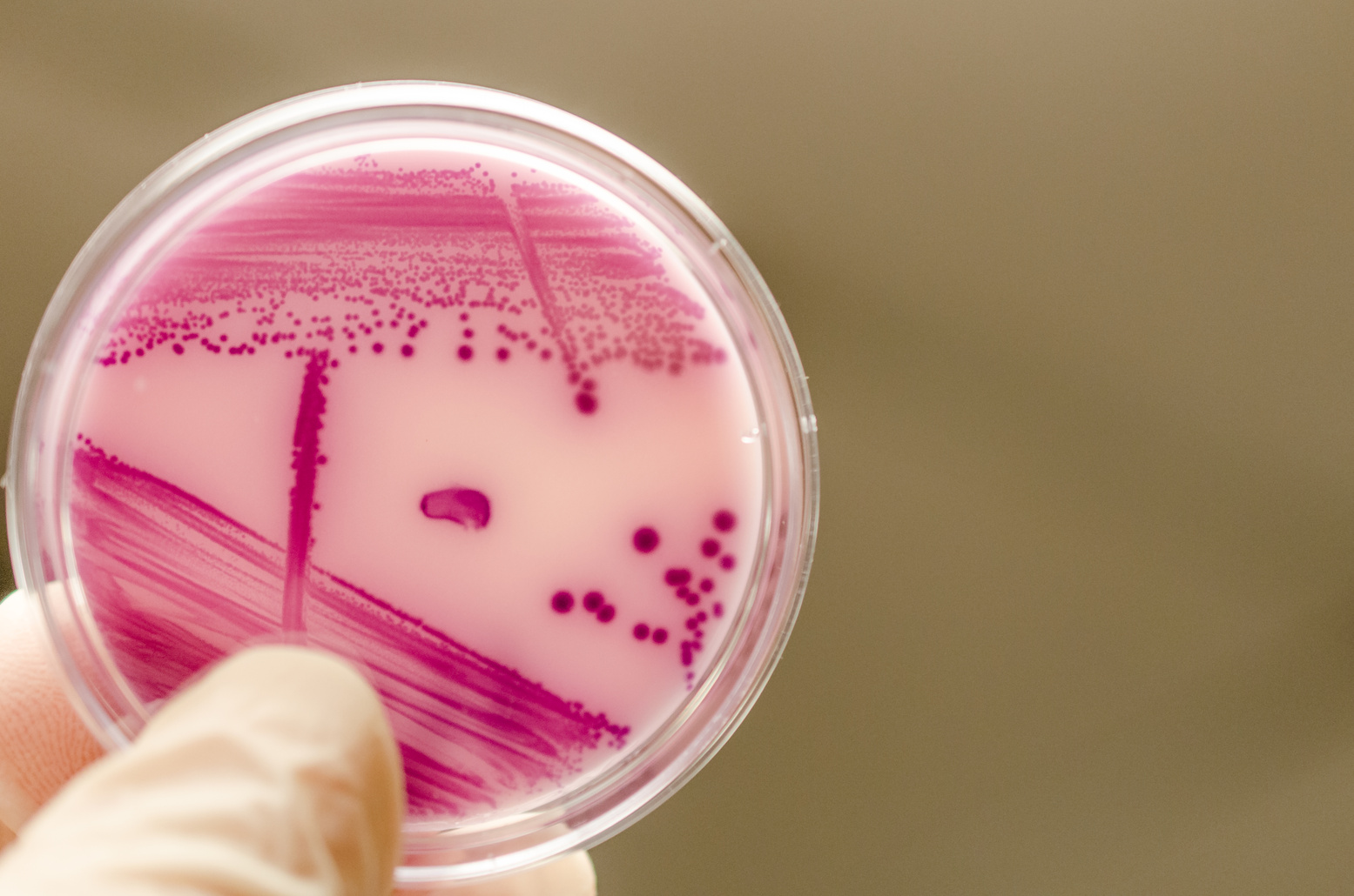 Bacterial culture plate